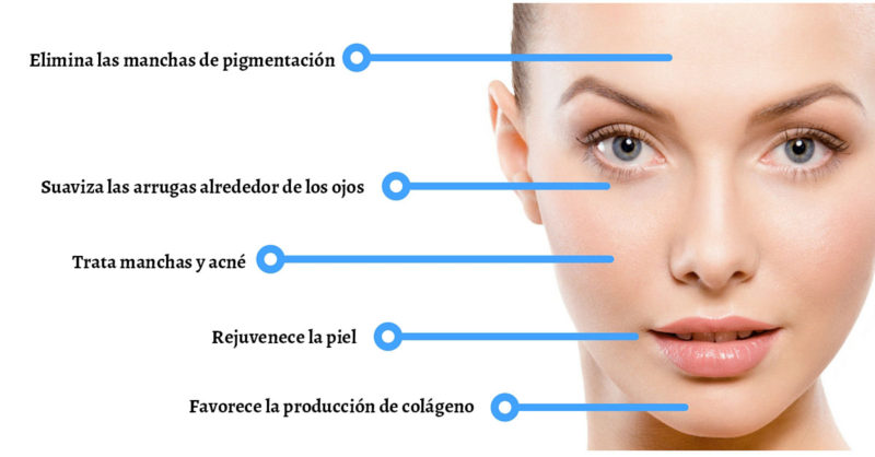 Beneficios de la mesoterapia facial